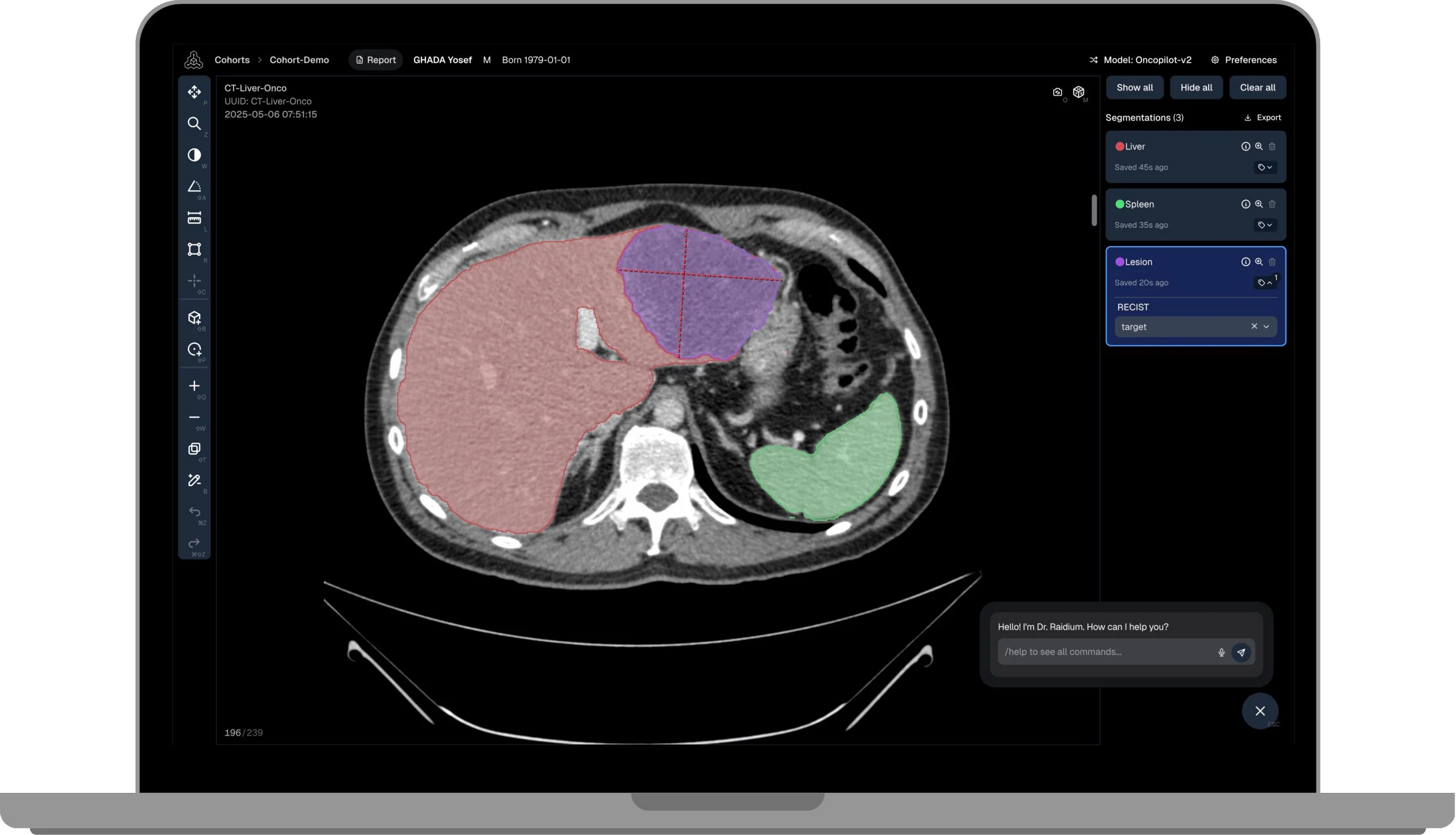 Healthcare AI Data Annotation
